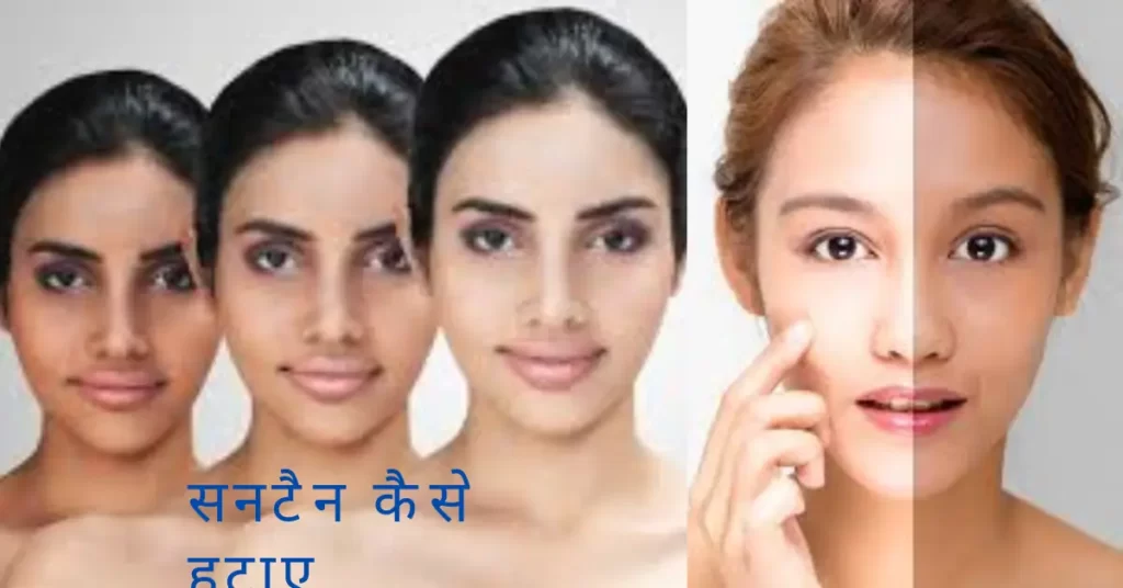 चेहरे की सनटैन हटाने के आसान और घरेलु तरीके: पाएं फिर से निखरी त्वचा 2 how to remove tan in hindi