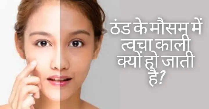 ठंड के मौसम में त्वचा काली क्यों हो जाती है? विंटर स्कीनकेयर 2 thand me skin kali kyu hoti hai
